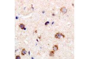 Immunohistochemical analysis of MYPT1 staining in human brain formalin fixed paraffin embedded tissue section.