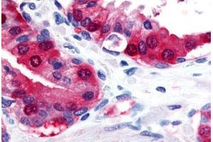 Anti-TRPM8 antibody  ABIN1049435 IHC staining of human prostate. (TRPM8 抗体  (Internal Region))