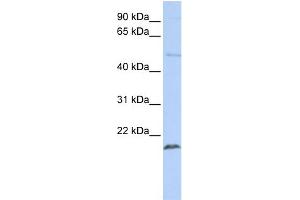 WB Suggested Anti-ZNF79 Antibody Titration:  0. (ZNF79 抗体  (N-Term))