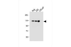 All lanes : Anti-ITGA8 Antibody (C-term) at 1:2000 dilution Lane 1: Raji whole cell lysate Lane 2: 293 whole cell lysate Lane 3: LNCaP whole cell lysate Lysates/proteins at 20 μg per lane.