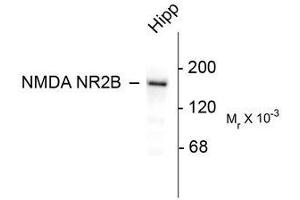 Image no. 1 for anti-Glutamate Receptor, Ionotropic, N-Methyl D-Aspartate 2B (GRIN2B) (C-Term) antibody (ABIN372682) (GRIN2B 抗体  (C-Term))