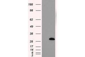 Image no. 1 for anti-Thiopurine S-Methyltransferase (TPMT) antibody (ABIN1501483) (TPMT 抗体)