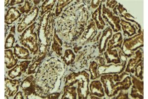 ABIN6267122 at 1/100 staining Mouse kidney tissue by IHC-P.