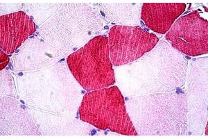 Human Skeletal Muscle: Formalin-Fixed, Paraffin-Embedded (FFPE) (UBE2O 抗体  (AA 1279-1292))