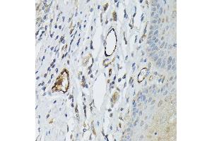 Immunohistochemistry (IHC) image for anti-Von Willebrand Factor (VWF) (AA 50-150) antibody (ABIN5663874)