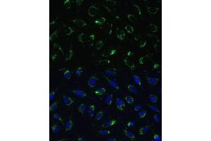 Immunofluorescence (IF) image for anti-Cytochrome C Oxidase Subunit Vb (COX5B) (AA 32-129) antibody (ABIN3016356)