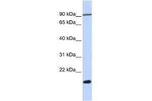 WB Suggested Anti-TM4SF4 Antibody Titration:  0. (TM4SF4 抗体  (N-Term))