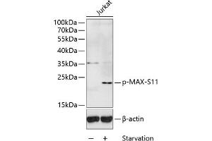 Western blot analysis of extracts of Jurkat cells, using Phospho-MAX-S11 antibody (ABIN3019514, ABIN3019515, ABIN3019516 and ABIN6225442) at 1:1000 dilution. (MAX 抗体  (pSer11))