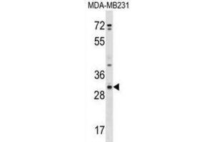 Western Blotting (WB) image for anti-Cysteine-Rich Secretory Protein 1 (CRISP1) antibody (ABIN2999601) (CRISP1 抗体)