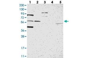 Western blot analysis of Lane 1: RT-4, Lane 2: U-251 MG, Lane 3: Human Plasma, Lane 4: Liver, Lane 5: Tonsil with C1orf116 polyclonal antibody . (C1orf116 抗体)