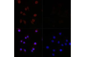 Immunofluorescence (IF) image for anti-Microtubule-Associated Protein 1 Light Chain 3 beta (MAP1LC3B) antibody (ABIN7268520)