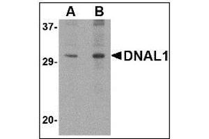 Western blot analysis of DNAL1 in 3T3 cell lysate with DNAL1 antibody at (A) 1 and (B) 2 µg/ml. (DNAL1 抗体  (C-Term))