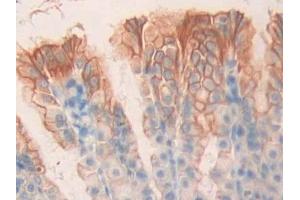 Detection of CHRM1 in Rat Stomach Tissue using Polyclonal Antibody to Cholinergic Receptor, Muscarinic 1 (CHRM1)