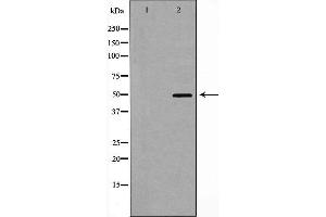 Western Blotting (WB) image for anti-Corticotropin Releasing Hormone Receptor 1 (CRHR1) (Internal Region) antibody (ABIN6261033)