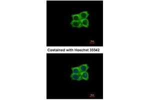 ICC/IF Image Immunofluorescence analysis of methanol-fixed A431, using Ladinin 1, antibody at 1:500 dilution. (Ladinin 1 抗体  (C-Term))