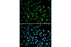 Immunofluorescence analysis of A549 cell using DDIT3 antibody. (DDIT3 抗体  (C-Term))