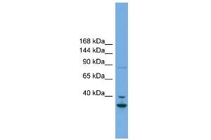 WB Suggested Anti-FSTL5 Antibody Titration: 0. (FSTL5 抗体  (Middle Region))