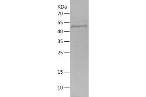 Myosin 9 Protein (MYH9) (AA 2-241) (His-IF2DI Tag)