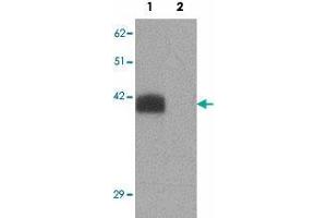 Western blot analysis of SLC39A2 in rat brain tissue lysate with SLC39A2 polyclonal antibody  at 1 ug/mL in (1) the absence and (2) the presence of blocking peptide. (ZIP2 抗体  (N-Term))