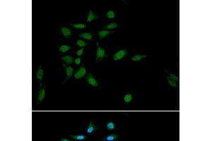 Immunofluorescence analysis of U2OS cells using PSMA1 Polyclonal Antibody at dilution of 1:100. (PSMA1 抗体)