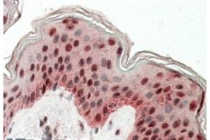 AP21273PU-N TIAL1 antibody staining of paraffin embedded Human Skin at 3. (TIAL1 抗体  (Internal Region))