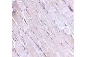 Immunohistochemistry of Wnt10b in human skeletal muscle with this product at 2. (WNT10B 抗体  (Center))