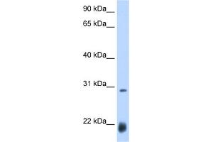 WB Suggested Anti-ac Antibody Titration:  0.