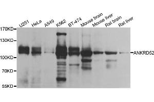 Western blot analysis of extracts of various cell lines, using ANKRD52 antibody. (ANKRD52 抗体)