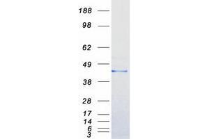 Western Blotting (WB) image for Guanine Nucleotide Binding Protein (G Protein), alpha Inhibiting Activity Polypeptide 2 (GNAI2) protein (Myc-DYKDDDDK Tag) (ABIN2721497)