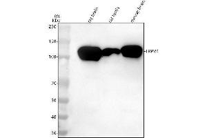 Western blot analysis of TRPV4 using anti-TRPV4 antibody (ABIN7602219).