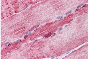 Human Skeletal muscle: Formalin-Fixed, Paraffin-Embedded (FFPE) (ATP2A1/SERCA1 抗体  (AA 522-613))