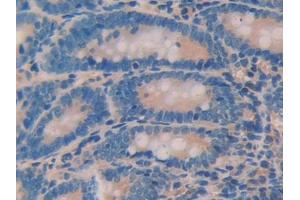 DAB staining on IHC-P; Samples: Rat Small intestine Tissue (ANGPTL2 抗体  (AA 47-207))