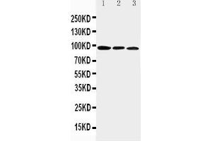 Western Blotting (WB) image for anti-Aryl Hydrocarbon Receptor (AHR) (AA 832-848), (C-Term) antibody (ABIN3043054)