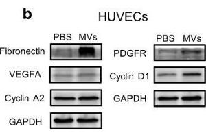 Effect of ASC-MV treatment on gene expression in all three kinds of cells. (Cyclin D1 抗体  (C-Term))