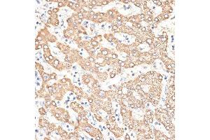 Immunohistochemistry of paraffin-embedded human liver using KIR3DS1 antibody.