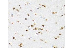 Immunohistochemistry of paraffin-embedded Mouse brain using DDX21 Polyclonal Antibody at dilution of 1:100 (40x lens). (DDX21 抗体)