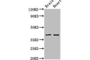 Western Blot Positive WB detected in: Rat brain tissue, Rat heart tissue All lanes: CERS1 antibody at 3 μg/mL Secondary Goat polyclonal to rabbit IgG at 1/50000 dilution Predicted band size: 40, 38 kDa Observed band size: 40 kDa (LASS1 抗体  (AA 1-52))