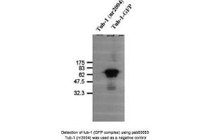 Image no. 1 for anti-Tubby Homolog (TUB) antibody (ABIN363362) (TUB 抗体)