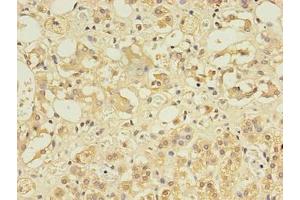 Immunohistochemistry of paraffin-embedded human adrenal gland tissue using ABIN7148084 at dilution of 1:100 (CCDC134 抗体  (AA 23-229))