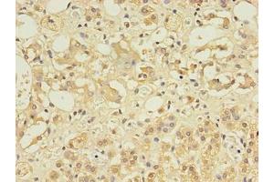 Immunohistochemistry of paraffin-embedded human adrenal gland tissue using ABIN7148084 at dilution of 1:100 (CCDC134 抗体  (AA 23-229))