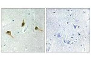 Immunohistochemistry analysis of paraffin-embedded human brain tissue using MSH2 antibody. (MSH2 抗体)