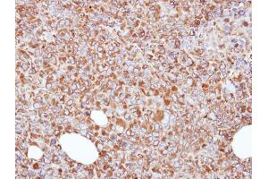 IHC-P Image Immunohistochemical analysis of paraffin-embedded H1299 xenograft, using ERp57, antibody at 1:500 dilution. (PDIA3 抗体  (C-Term))