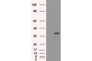 Image no. 2 for anti-Protein Phosphatase Methylesterase 1 (PPME1) antibody (ABIN1500298) (PPME1 抗体)