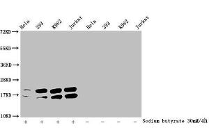 Western Blot Detected samples: Hela whole cell lysate, 293 whole cell lysate, K562 whole cell lysate, Jurkat whole cell lysate, Untreated (-) or treated (+) with 30 mM sodium butyrate for 4h All lanes: HIST1H1C antibody at 1:2000 Secondary Goat polyclonal to rabbit IgG at 1/40000 dilution Predicted band size: 22 kDa Observed band size: 22 kDa (HIST1H1C 抗体  (acLys96))