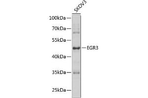 Western blot analysis of extracts of SKOV3 cells, using EGR3 antibody (ABIN6127828, ABIN6139993, ABIN6139994 and ABIN6223592) at 1:1000 dilution. (EGR3 抗体  (AA 1-250))