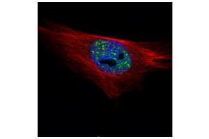 Immunofluorescence (IF) image for anti-Protein Phosphatase 1, Catalytic Subunit, alpha Isoform (PPP1CA) (Center) antibody (ABIN2856071)