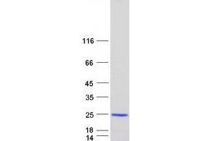 Western Blotting (WB) image for Vacuolar Protein-Sorting-Associated Protein 25 (VPS25) protein (Myc-DYKDDDDK Tag) (ABIN2735417)