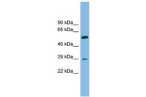 WB Suggested Anti-TM4SF20 Antibody Titration: 0. (TM4SF20 抗体  (Middle Region))