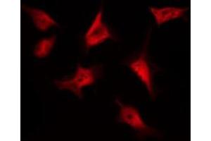 ABIN6269220 staining SW626 by IF/ICC. (CTNNB1 抗体  (N-Term))