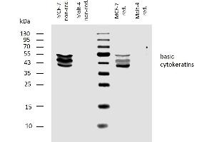 Western blotting analysis of human basic cytokeratins using mouse monoclonal antibody AE3 on lysates of MCF-7 cell line and Molt-4 cell line (cytokeratin non-expressing cell line, negative control) under non-reducing and reducing conditions. (Keratin Basic 抗体)